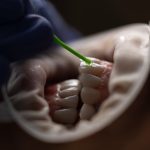 When To See An Emergency Dentist And What To Expect