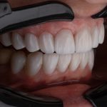 How Family Dentistry Supports Healthy Smiles At Every Age