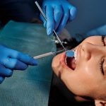 5 Advanced Bone Grafting Techniques In Implant Preparation