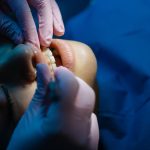 How To Maintain Cosmetic Dental Results With Preventive Family Care